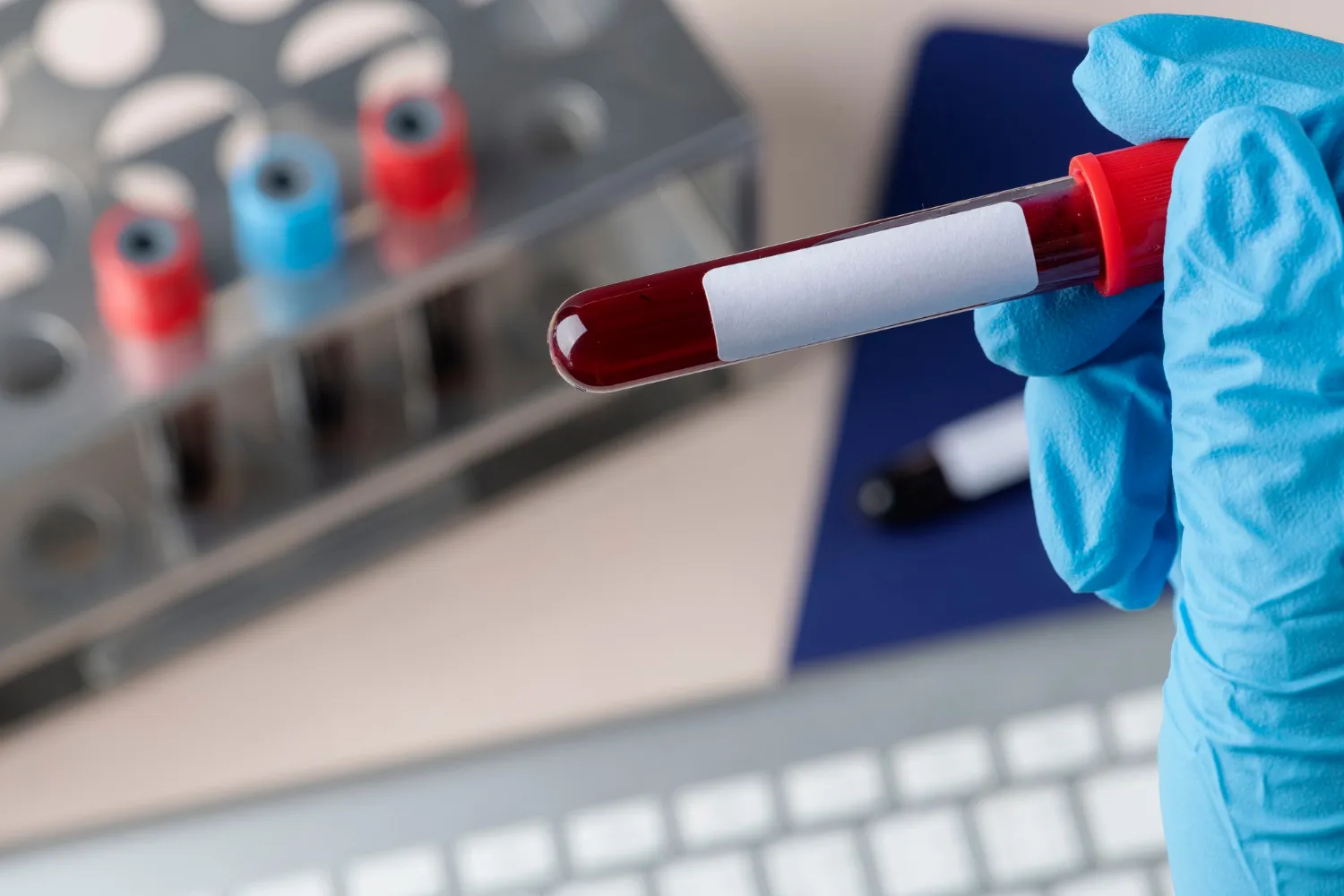 Focused hormone lab testing and blood work analysis